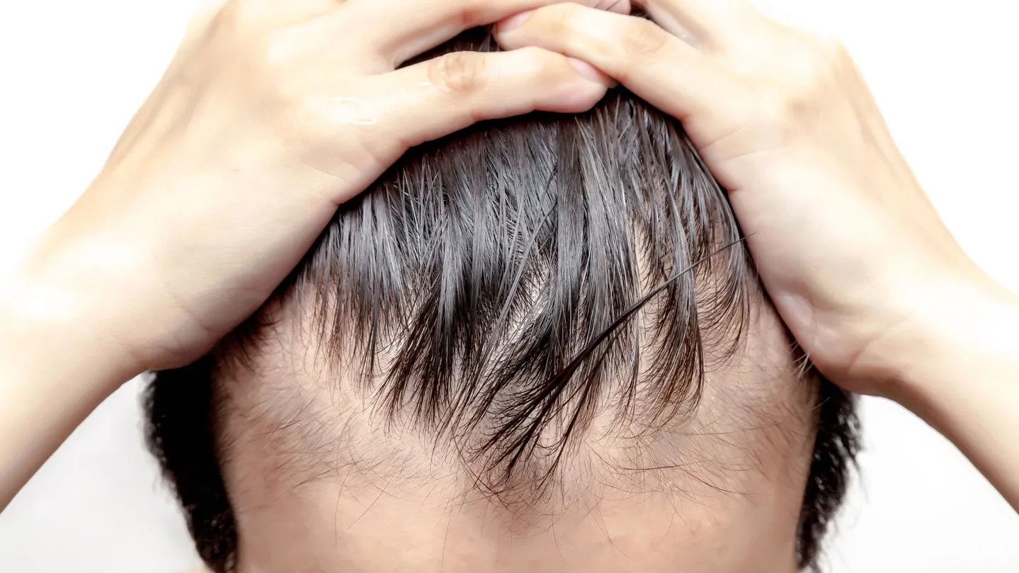 Is there really a hair pulling disorder treatment?