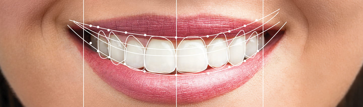 Effective Tips to Take Care of Your Smile Makeover Results