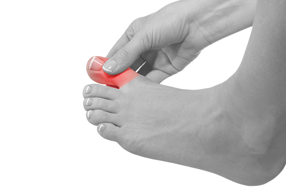 Benefits of Laser Ingrown Toenail Removal Treatment at The Podiatry Clinic