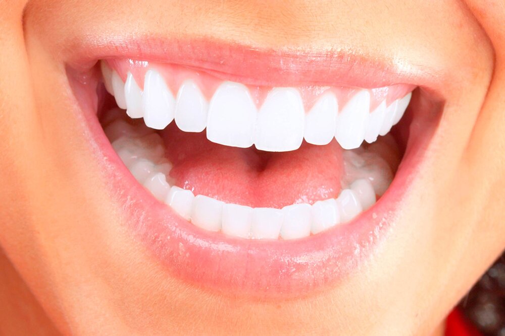 How a Brighter Smile Can Take Years Off Your Appearance 