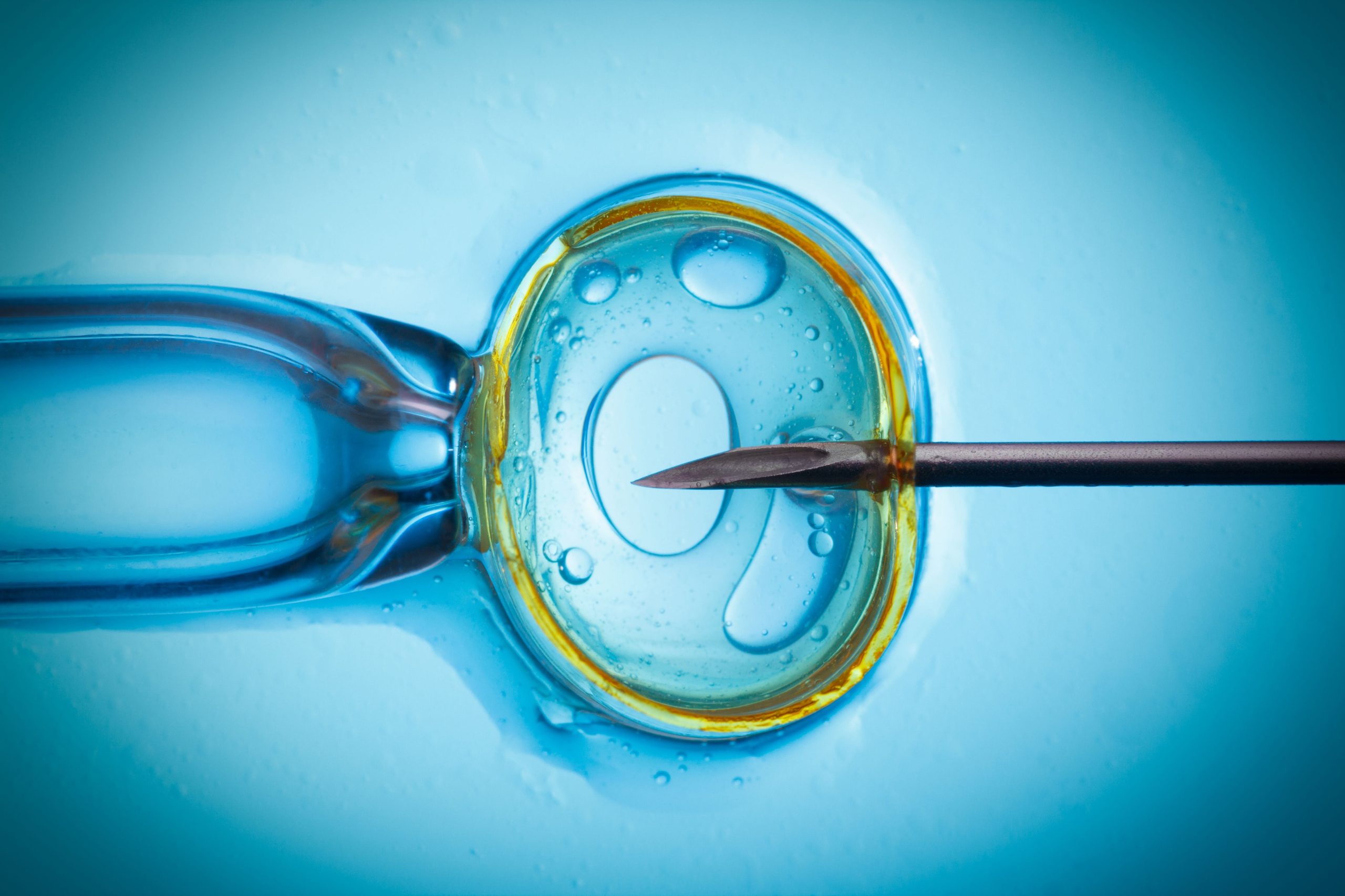 How ICSI can help in infertility