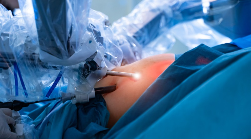 Post-Bariatric Surgery
