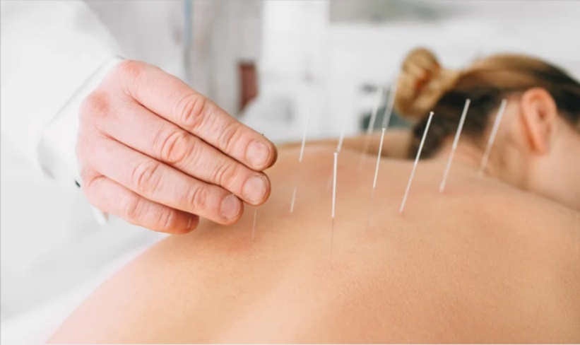 Acupuncture for Sleep Disorders