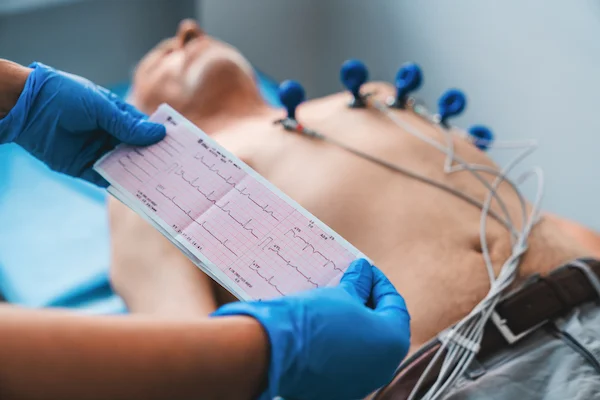 ECG Test